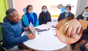 Alerta por varicela en Juliaca: 91 escolares contagiados y 7 instituciones intervenidas, incluida una universidad