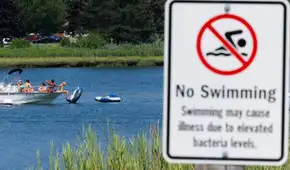 Menor muere tras contraer una ameba 'comecerebros' después de nadar en un lago de Estados Unidos Menor muere tras contraer una ameba 'comecerebros' después de nadar en un lago de Estados Unidos