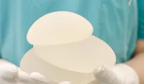 Alerta internacional por implantes médicos prohibidos en Brasil: Digemid continúa evaluando uso de productos en Perú Alerta internacional por implantes médicos prohibidos en Brasil: Digemid continúa evaluando uso de productos en Perú