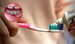 ¿Qué es el fluoruro de estaño y por qué el Digemid lo calificó de riesgoso? Está presente en la pasta Colgate Total Clean Mint y en 13 cremas más ¿Qué es el fluoruro de estaño y por qué el Digemid lo calificó de riesgoso? Está presente en la pasta Colgate Total Clean Mint y en 13 cremas más