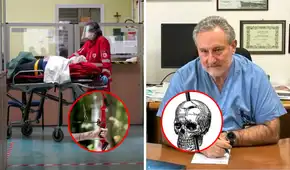 Adulto mayor sobrevivió dos días con una flecha clavada en la cabeza y llegó consciente al hospital en Italia Adulto mayor sobrevivió dos días con una flecha clavada en la cabeza y llegó consciente al hospital en Italia