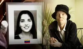 Venezolana sufrió grave accidente por un conductor ebrio, no logró trasplante de cara y terminó siendo un símbolo en EEUU