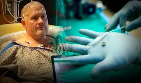 Un implante cerebral permite a un hombre sentir alegría tras más de 30 años de depresión severa