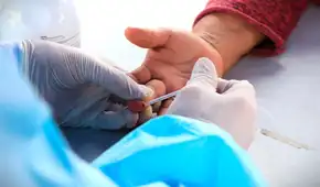 ¿Cómo reconocer si tengo sífilis? La enfermedad que sí tiene cura si se detecta a tiempo, según Minsa