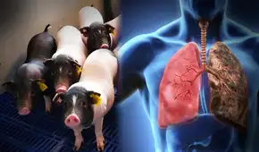 Científicos chinos hacen historia con el primer trasplante de pulmón de cerdo a un humano en estado de muerte cerebral