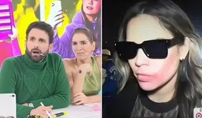 ‘Peluchín’ consternado tras notar extraño detalle en los rostros de Andrea San Martín y Yerko en concierto: “¿Qué le pasó en la cara?"