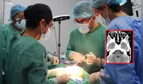 Médicos salvan la vida de un niño que llegó de Jaén a Lima porque tenía una piedra incrustada en el cráneo