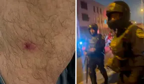 Cuatro periodistas son agredidos por la PNP: dos recibieron impactos de perdigones, mientras que el otro fue golpeado