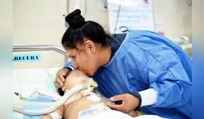 Niños con enfermedades del corazón y una operación riesgosa para salvarles la vida