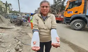 Mujer intentó salvar sus cosas en incendio en Pamplona Alta, pero se quemó ambos brazos: “No tengo nada” Mujer intentó salvar sus cosas en incendio en Pamplona Alta, pero se quemó ambos brazos: “No tengo nada”