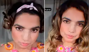 Susana Alvarado muestra su cirugía nasal: integrante de Corazón Serrano se operó por motivos de salud