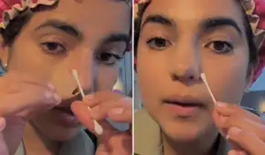 Susana Alvarado de Corazón Serrano muestra cómo luce su renovada nariz y enseña paso a paso su cuidado postoperatorio: "Va excelente"