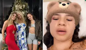 Thamara Medina, hermana de Alejandra Baigorria, muestra cómo luce tras accidente vehicular y relata lo sucedido