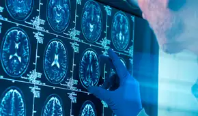 No es en la adolescencia: científicos revelan la edad en que el cerebro llega a la madurez y cuándo empieza a envejecer