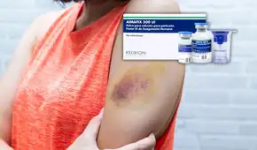 Pacientes con hemofilia denuncian que llevan meses sin tratamiento por escasez de fármaco en EsSalud y Minsa