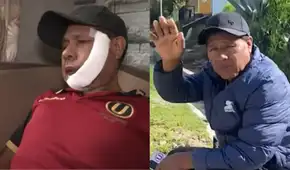 Adulto mayor sufre corte en su rostro al defender a su hija de sujetos en Villa El Salvador: recibió 26 puntos de sutura