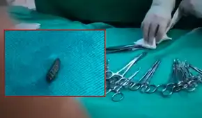 Larvas de mosca caen del techo durante cirugías en el Hospital Materno Infantil de Huancayo y desatan alarma sanitaria