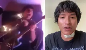 Cantante peruano sufre descarga eléctrica durante concierto en Centro de Lima y revela cómo sobrevivió al incidente: "Tengo quemaduras"