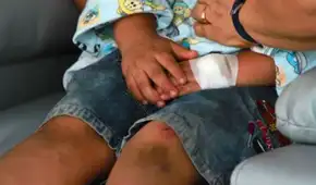 Denuncian falta de medicamentos para 2 millones de pacientes con enfermedades raras en Perú: ''No hay voluntad política"