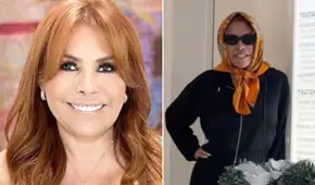 Magaly Medina responde a comentarios en redes por su reciente cirugía facial: "No es una operación fácil"