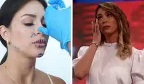 Sheyla Rojas evalúa revertir sus procedimientos estéticos: "Me había puesto tanto ácido hialurónico"