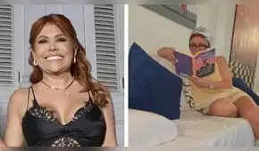 Magaly Medina comparte sin filtros su proceso de recuperación tras cirugía facial: “Mostrándoles orgullosamente mis moretones”