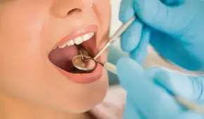 Científicos brasileños crean una saliva artificial de caña de azúcar que protege los dientes de las caries graves