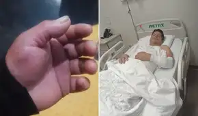 Agente de seguridad de la ATU denuncia abandono de autoridades tras ser atacado con un martillo en estación Naranjal