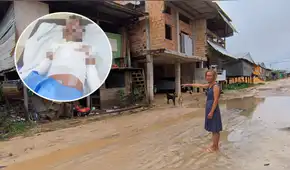 Desconocidos rociaron gasolina a menor de 13 años en Iquitos: adolescente elaboraba una máscara para un carnaval cuando fue atacado