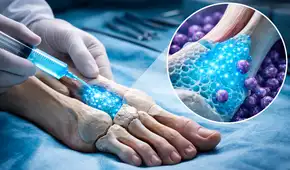 Científicos suizos crean un nuevo hidrogel que podría ser clave para reparar las graves fracturas óseas en corto tiempo