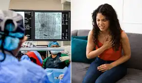 Infartos aumentan en menores de 50 años en Perú: EsSalud reporta atención de un caso al día