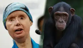 La historia de Charla Nash, la mujer que sobrevivió al ataque del chimpancé Travis en EE. UU.: enfrentó años de reconstrucción facial