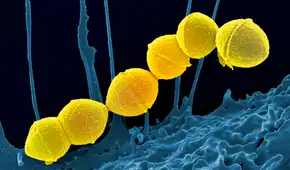 Una momia prehispánica revela que la bacteria de la faringitis ya existía en América antes de la llegada de los europeos