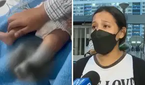 Madre denuncia que su bebé sufrió quemaduras en el Rebagliati y pide ayuda legal: “No tengo apoyo del hospital"