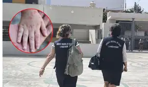 Alerta por virus coxsakie: 38 colegios de Chiclayo reportan el brote de la enfermedad de mano, pie y boca entre sus alumnos