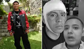 Ángeles streamer Ángel Ramírez herido tras golpiza en discoteca con corte en frente