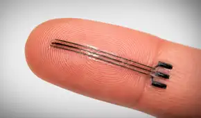 Científicos desarrollan un innovador implante 3D que reduce la presión arterial mediante estimulación eléctrica suave