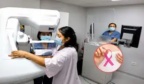 ¿Necesitas una mamografía? Hospital Santa Rosa ofrece este examen médico 100% gratuito sin seguro ni orden médica desde esta fecha