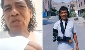 Cómico ‘Cachay’ revela delicado estado de salud tras fuerte agresión en pleno show: “Se me han abierto los huesos”
