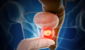 Ensayo clínico internacional demuestra eficacia de terapia combinada en cáncer de próstata agresivo: menos progresión y menor mortalidad