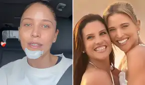Anna Carina Copello, hermana de María Pía, sufre grave accidente y termina con múltiples lesiones: "Fue una pesadilla"