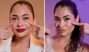 Melanie Martínez impacta al mostrar su nuevo rostro tras someterse a cirugía estética: “Gracias por devolverme la juventud”