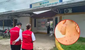 Sin fondos para emergencia por sarampión: pacientes en riesgo y posible aumento de contagios en Madre de Dios