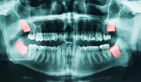 Científicos estudiaron dientes de ratón y descubrieron por qué las muelas del juicio causan tantos problemas en humanos