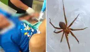 Menor fallece tras ser mordida por una araña en su vivienda: ataque le habría provocado insuficiencia renal aguda