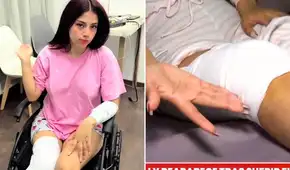 TikToker Zully recibe 40 puntos en la pierna tras sufrir aparatoso accidente y reaparece en silla de ruedas: "Tuve todos esos cortes" TikToker Zully recibe 40 puntos en la pierna tras sufrir aparatoso accidente y reaparece en silla de ruedas: "Tuve todos esos cortes"