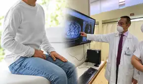 INEN ofrece evaluación gratuita de próstata a más de 1.000 hombres en Surquillo: ¿cómo acceder?