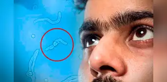 ¿Por qué sueles ver ‘gusanitos’ en tu campo visual? Esto dice la ciencia ¿Por qué sueles ver ‘gusanitos’ en tu campo visual? Esto dice la ciencia