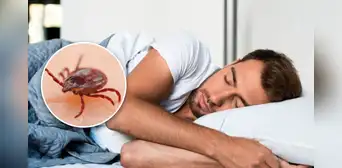 ¿Cuál es el verdadero significado de soñar con garrapatas? ¿Cuál es el verdadero significado de soñar con garrapatas?