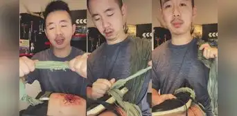 TikTok viral: doctor tiktoker enseña primeros auxilios para heridos ante contexto de guerra TikTok viral: doctor tiktoker enseña primeros auxilios para heridos ante contexto de guerra